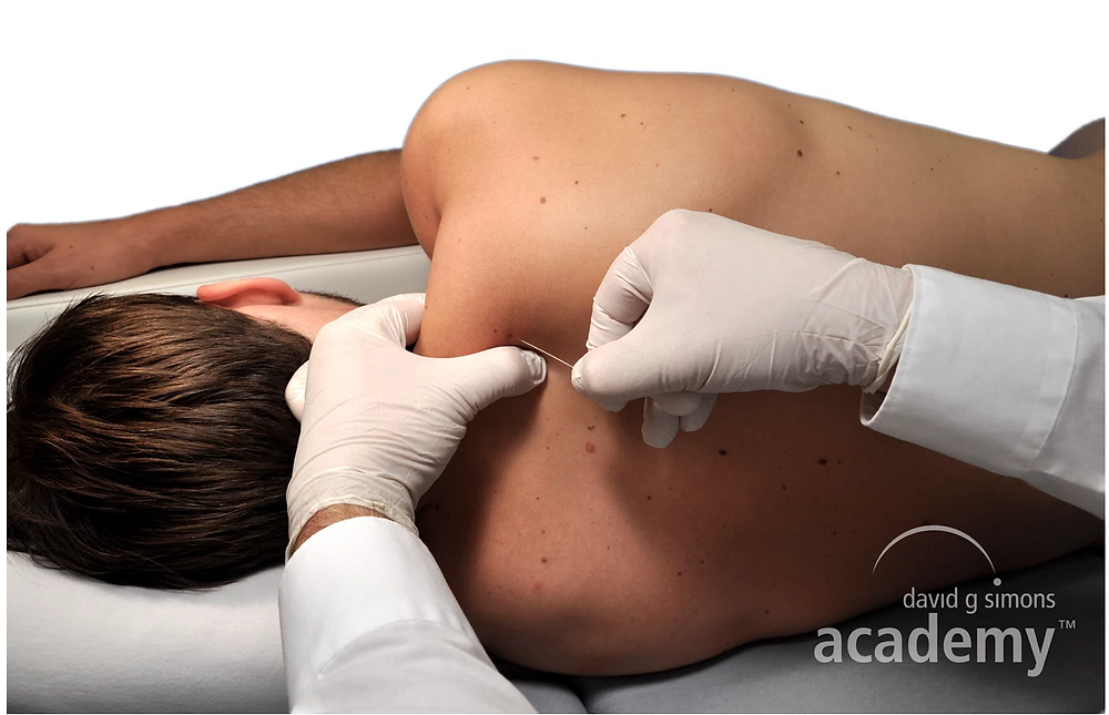 Devenez thérapeute Dry Needling avec Physio 7 School